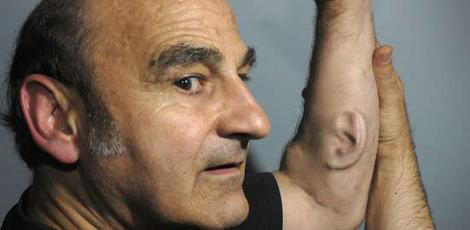 Stelarc, Ear on Arm, 2006-